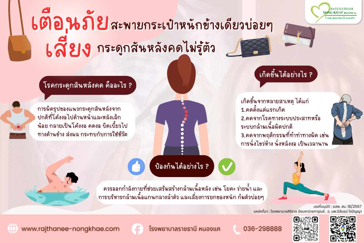 สะพายกระเป๋าข้างเดียวหนักบ่อยๆ เสี่ยงโรคกระดูกสันหลังคด