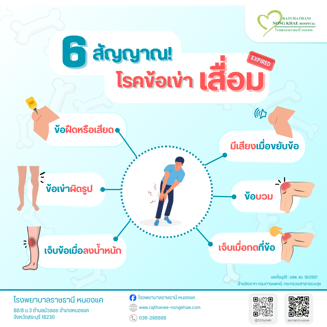 สัญญานเตือนโรคข้อเข่าเสื่อม