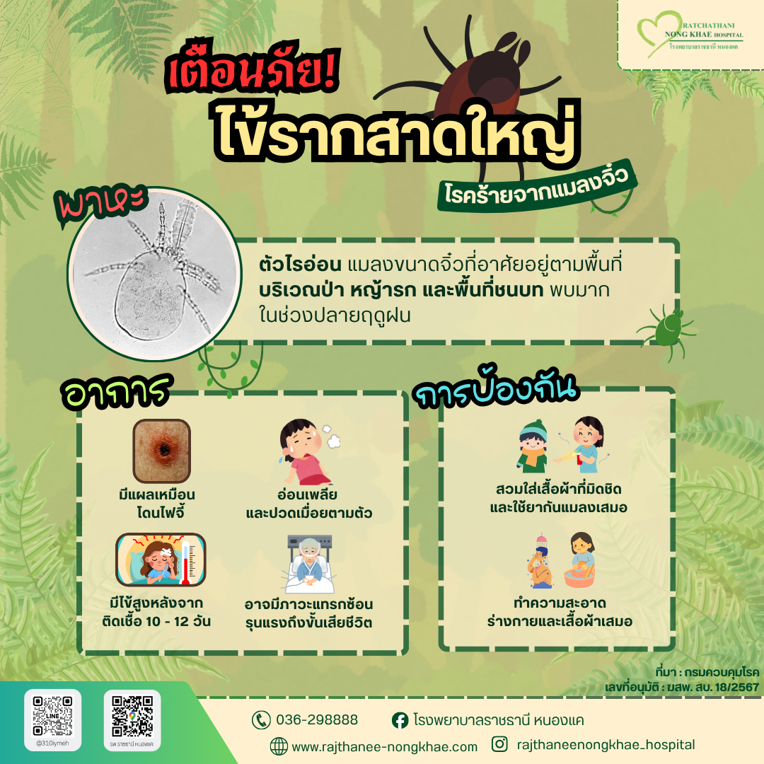 ไข้รากสาดใหญ่